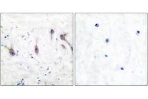Immunohistochemistry analysis of paraffin-embedded human brain tissue, using ARC Antibody. (ARC (AA 159-208) Antikörper)