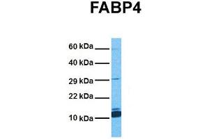Host:  Rabbit  Target Name:  FABP4  Sample Tissue:  Human Stomach Tumor  Antibody Dilution:  1. (FABP4 Antikörper  (Middle Region))