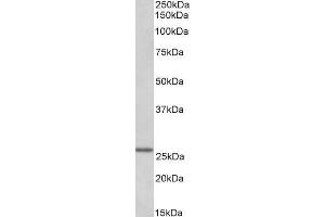 Western Blotting (WB) image for anti-Linker For Activation of T Cells Family, Member 2 (LAT2) (Internal Region) antibody (ABIN1590104)