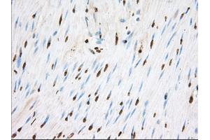 Image no. 1 for anti-Transforming, Acidic Coiled-Coil Containing Protein 3 (TACC3) antibody (ABIN1498097) (TACC3 Antikörper)