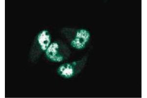Immunofluorescence staining of AN3 CA cells (Human endometrial adenocarcinoma, ATCC HTB-111). (PCNA Antikörper  (AA 68-230))