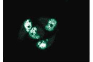 Immunofluorescence staining of AN3 CA cells (Human endometrial adenocarcinoma, ATCC HTB-111).