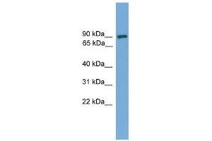 Western Blot showing DEPDC1 antibody used at a concentration of 1-2 ug/ml to detect its target protein.