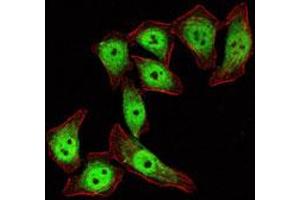 Immunofluorescence analysis of Eca-109 cells using KLF4 monoclonal antibody, clone 1E6  (green) .