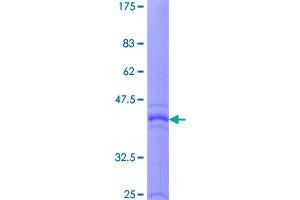 Image no. 1 for Interleukin 5 (IL5) (AA 1-134) protein (GST tag) (ABIN1307830)