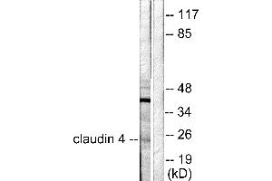 Western blot analysis of extracts from HeLa cells, using Claudin 4 antibody (#C0141). (Claudin 4 Antikörper)