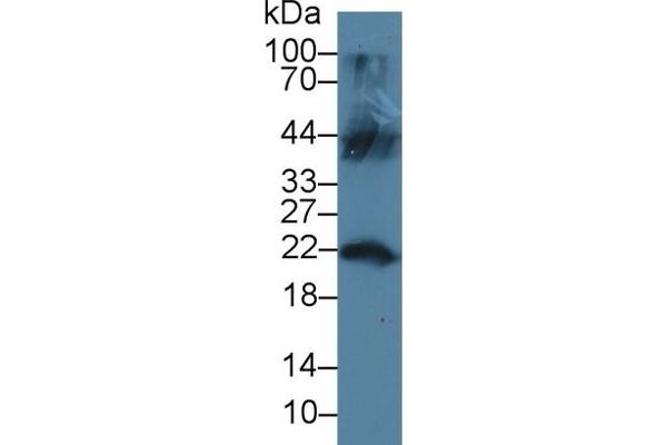 LCN12 anticorps  (AA 61-184)