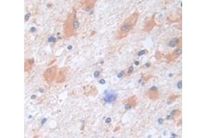 IHC-P analysis of Human Tissue, with DAB staining. (CPE Antikörper  (AA 318-476))