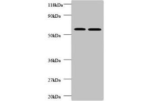 Western blot All lanes: FUCA2 antibody at 2 μg/mL Lane 1: EC109 whole cell lysate Lane 2: 293T whole cell lysate Secondary Goat polyclonal to rabbit IgG at 1/10000 dilution Predicted band size: 55, 20 kDa Observed band size: 55 kDa (FUCA2 Antikörper  (AA 29-465))