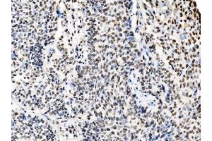 IHC analysis of DBC-1/CCAR2 using anti-DBC-1/CCAR2 antibody (ABIN7602235).