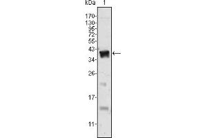 Western blot analysis using Androgen receptor mouse mAb against human recombinant Androgen receptor. (Androgen Receptor Antikörper)