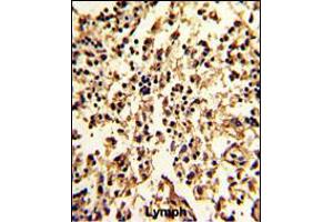 Formalin-fixed and paraffin-embedded human lymph with SERPINA9 Antibody , which was peroxidase-conjugated to the secondary antibody, followed by DAB staining. (SERPINA9 Antikörper  (AA 194-222))