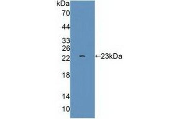 Glutamate Receptor 3 Antikörper  (AA 649-823)