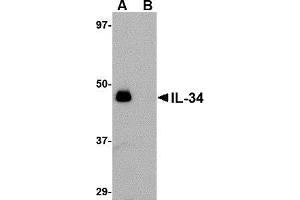 Western blot analysis of IL-34 in human brain tissue lysate with AP30428PU-N IL-34 antibody at 0.