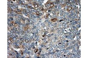 Immunohistochemical staining of paraffin-embedded Kidney tissue using anti-SIL1 mouse monoclonal antibody. (SIL1 Antikörper)