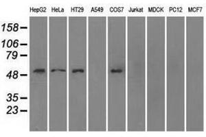Image no. 2 for anti-Solute Carrier Family 2 (Facilitated Glucose/fructose Transporter), Member 5 (SLC2A5) antibody (ABIN1498479) (SLC2A5 Antikörper)