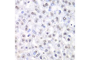 Immunohistochemistry of paraffin-embedded rat liver using Nono Antibody (ABIN5973035) at dilution of 1/100 (40x lens). (NONO Antikörper)