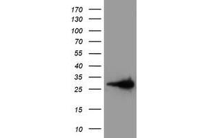 Western Blotting (WB) image for anti-Latexin (LXN) antibody (ABIN1499099)
