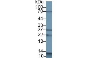 Detection of S100A12 in Porcine Spleen lysate using Polyclonal Antibody to S100 Calcium Binding Protein A12 (S100A12) (S100A12 Antikörper  (AA 2-92))