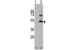 Image no. 1 for anti-Microtubule-Associated Protein tau (MAPT) antibody (ABIN356907) (MAPT Antikörper)