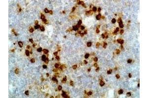 Immunohistochemical staining (Formalin-fixed paraffin-embedded sections) of human tonsil tissue with Human Ig lambda light chain monoclonal antibody, clone RM127  under 1 ug/mL working concentration. (IGLC1 Antikörper)