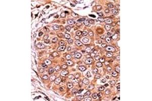 Image no. 2 for anti-SMAD, Mothers Against DPP Homolog 3 (SMAD3) (pSer208) antibody (ABIN358225)
