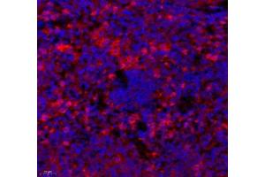 Immunofluorescence of paraffin embedded mouse spleen using cfap58 (ABIN7073535) at dilution of 1: 650 (400x lens) (CCDC147 Antikörper)
