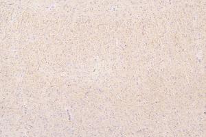 IHC analysis of SEMA3B using anti-SEMA3B antibody (ABIN6719617).