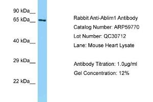 Western Blotting (WB) image for anti-Actin Binding LIM Protein 1 (ABLIM1) (Middle Region) antibody (ABIN2788205)