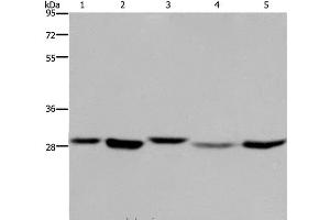 Western Blot analysis of 293T, MCF-7 and PC3 cell, Human fetal liver tissue and Hela cell using ECHS1 Polyclonal Antibody at dilution of 1:300 (ECHS1 Antikörper)