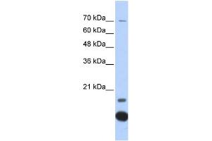 WB Suggested Anti-TXN2 Antibody Titration: 0.