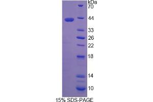Image no. 1 for Retinaldehyde Binding Protein 1 (RLBP1) (AA 1-317) protein (His tag) (ABIN6237901)