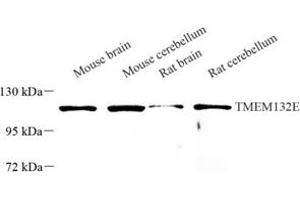 Western blot analysis of TMEM132E (ABIN7075991) at dilution of 1: 250 (TMEM132E Antikörper)