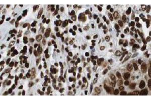 Image no. 3 for anti-Histone Deacetylase 1 (HDAC1) (AA 466-482) antibody (ABIN401309) (HDAC1 Antikörper  (AA 466-482))