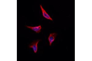 ABIN6264577 and ABIN6273305 staining Hela by IF/ICC. (RAB3A Antikörper  (N-Term))