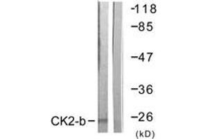 Western blot analysis of extracts from HuvEc cells, using CKII-beta (Ab-209) Antibody.