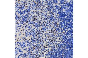 Immunohistochemistry of paraffin-embedded rat spleen using K/TRIM28 antibody (ABIN7270986) at dilution of 1:100 (40x lens). (KAP1 Antikörper)