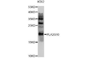 Western blot analysis of extracts of K562 cells, using PLA2G10 antibody (ABIN4904779) at 1:1000 dilution. (PLA2G10 Antikörper)