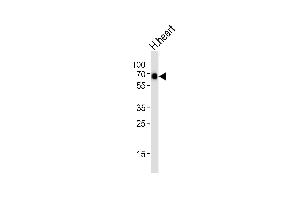 Western blot analysis of lysate from hun heart tissue lysate, using SRCD3 Antibody (N-term) (ABIN6242643 and ABIN6577395). (SMARCD3 Antikörper  (N-Term))