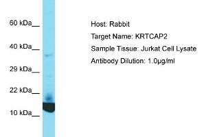 Host: Rabbit Target Name: KRTCAP2 Sample Tissue: Human Jurkat Whole Cell Antibody Dilution: 1ug/ml