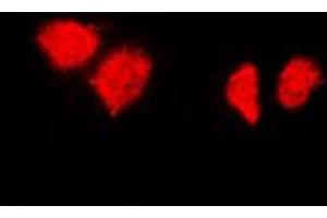 Immunofluorescent analysis of HSP40 staining in HeLa cells. (DNAJB1 Antikörper  (C-Term))