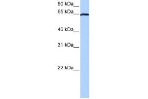 WB Suggested Anti-EBF4 Antibody Titration:  0. (EBF4 Antikörper  (C-Term))