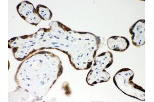 Immunohistochemistry (Paraffin-embedded Sections) (IHC (p)) image for anti-Pregnancy-Associated Plasma Protein A, Pappalysin 1 (PAPPA) (AA 95-388) antibody (ABIN3043377) (PAPPA Antikörper  (AA 95-388))