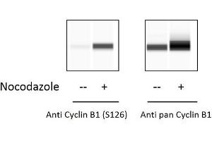 HeLa cells were untreated or treated with Nocodazole for 20 hours. (Cyclin B1 ELISA Kit)