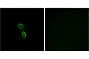Immunofluorescence analysis of A549 cells, using ARMC6 Antibody. (ARMC6 Antikörper  (AA 431-480))