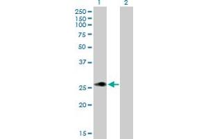 Western Blot analysis of MLX expression in transfected 293T cell line by MLX MaxPab polyclonal antibody. (MLX Antikörper  (AA 1-214))