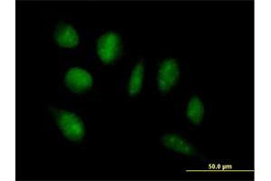 Immunofluorescence of purified MaxPab antibody to ADAMTSL4 on HeLa cell. (ADAMTSL4 Antikörper  (AA 1-424))