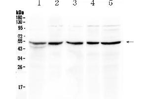 Western blot analysis of EIF3e using anti- EIF3e antibody . (EIF3E Antikörper  (AA 160-241))