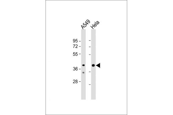 JMJD5 Antikörper  (N-Term)