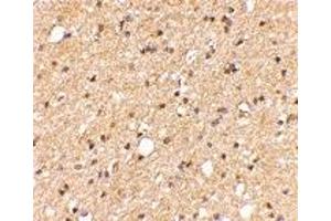 Immunohistochemistry (IHC) image for anti-Leucine-Rich Repeat LGI Family, Member 2 (LGI2) (Middle Region) antibody (ABIN1030982) (LGI2 Antikörper  (Middle Region))